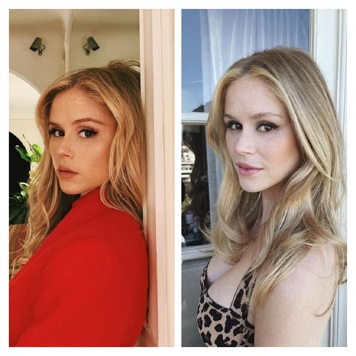 Did Erin Moriarty Get A Nose And Lips Done? Plastic Surgery
